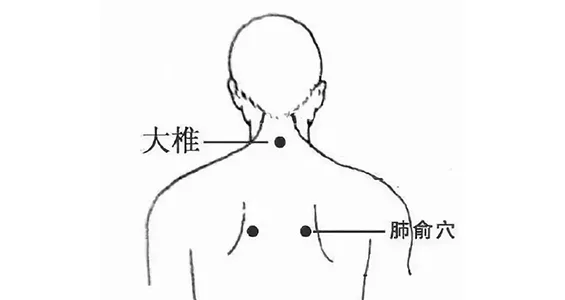 BL13 acupressure point on the upper back
